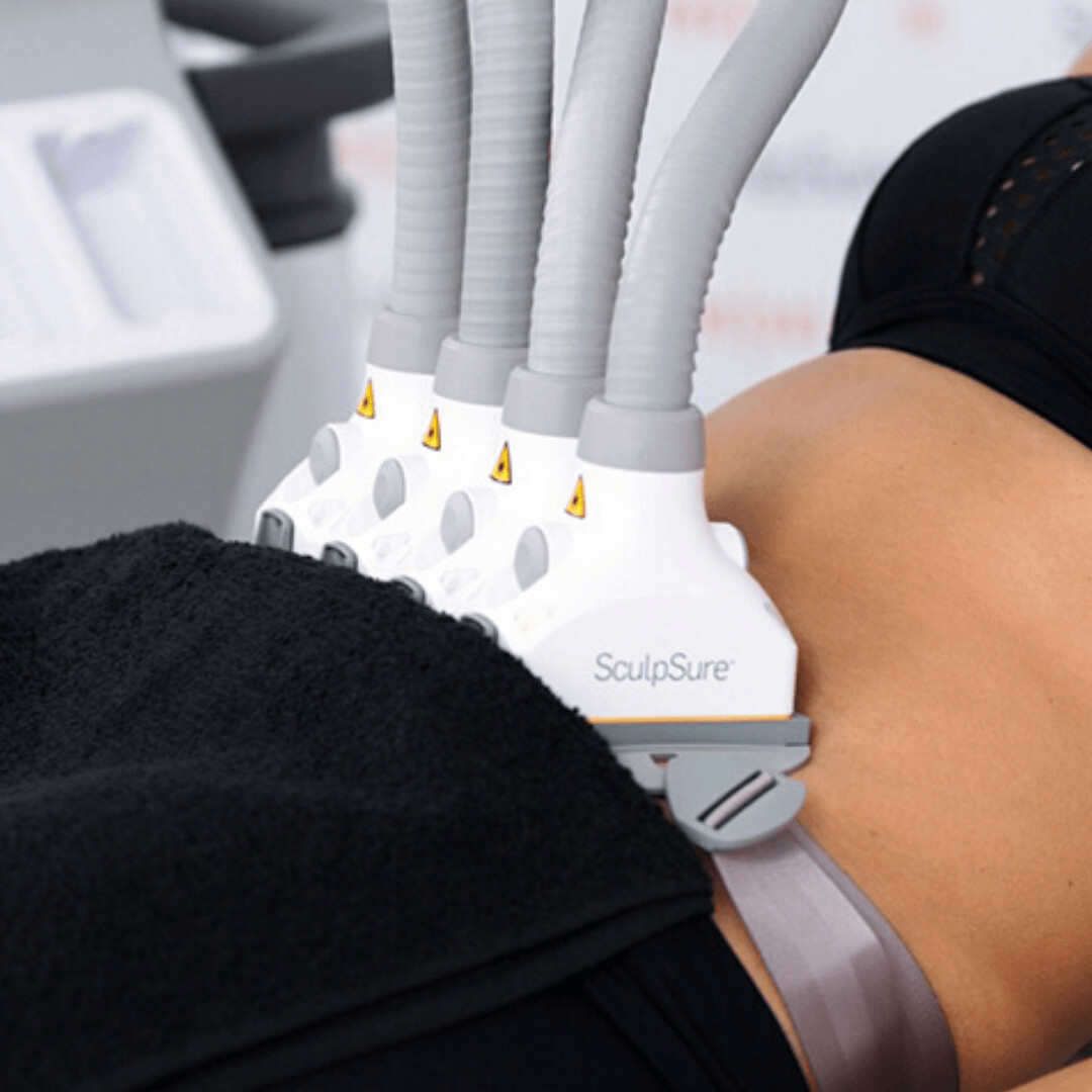 sculpsure body contouring