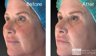 vivace blends skin color